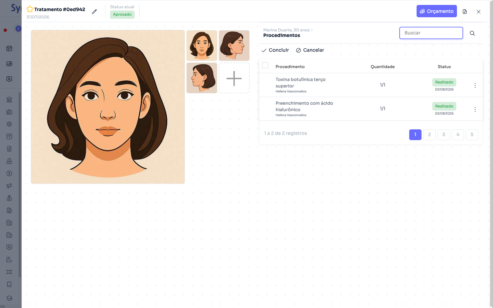 Planejamento de harmonização sobre o diagrama facial, com os procedimentos realizados ao lado